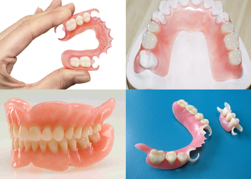 syemny-protez-zubov2.jpg